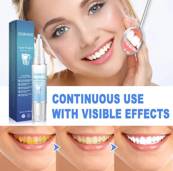 Teeth whitening gel product, smiling woman, before and after white teeth results illustration.